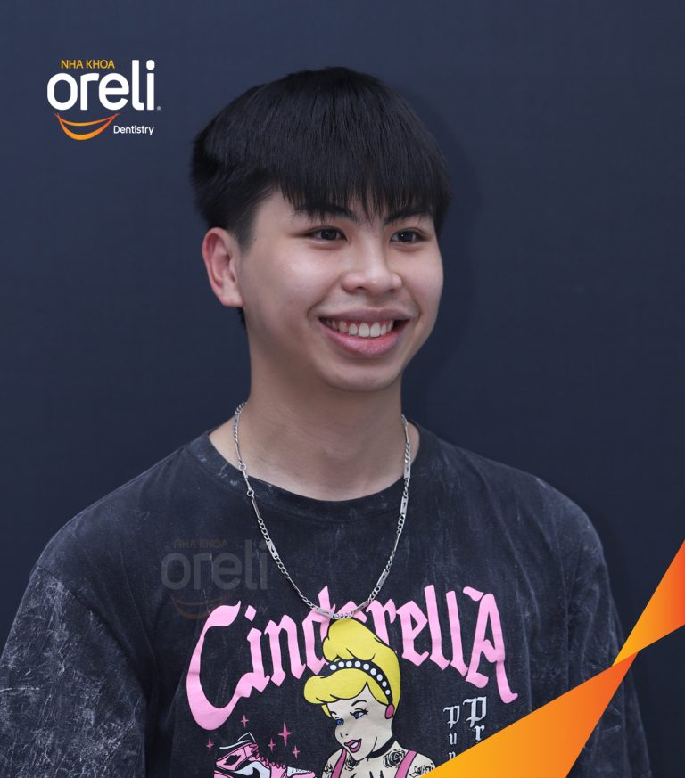 Ca niềng chỉnh hô và khe thưa cho nụ cười đẹp ở Oreli
