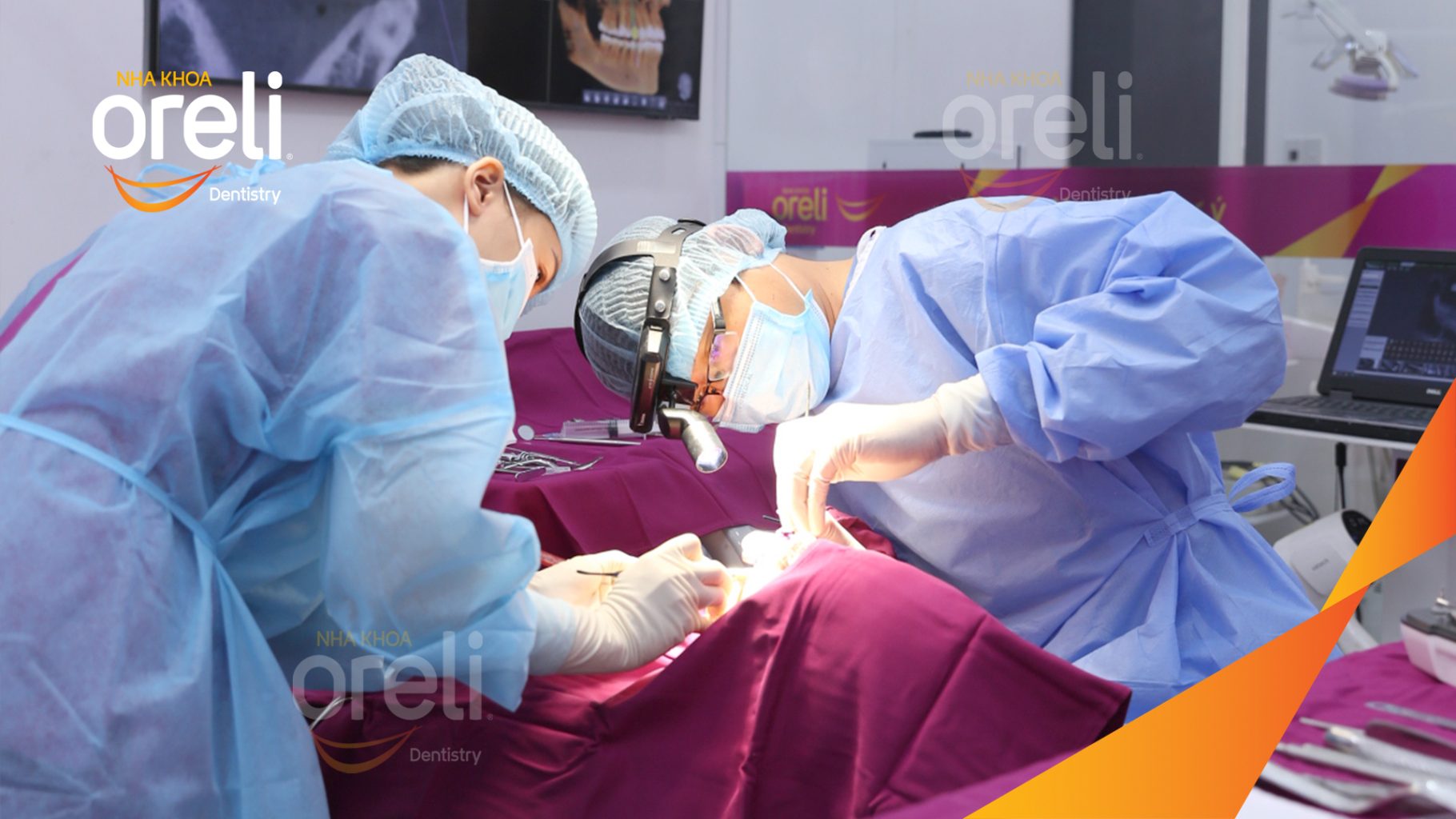 Mất răng hàm trên trước khi điều trị tại Oreli