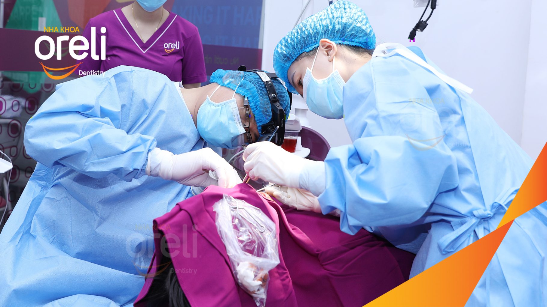 Thực hiện Cấy ghép trụ Implant chính hãng vào vùng mất răng kéo dài 3 tháng tại Oreli