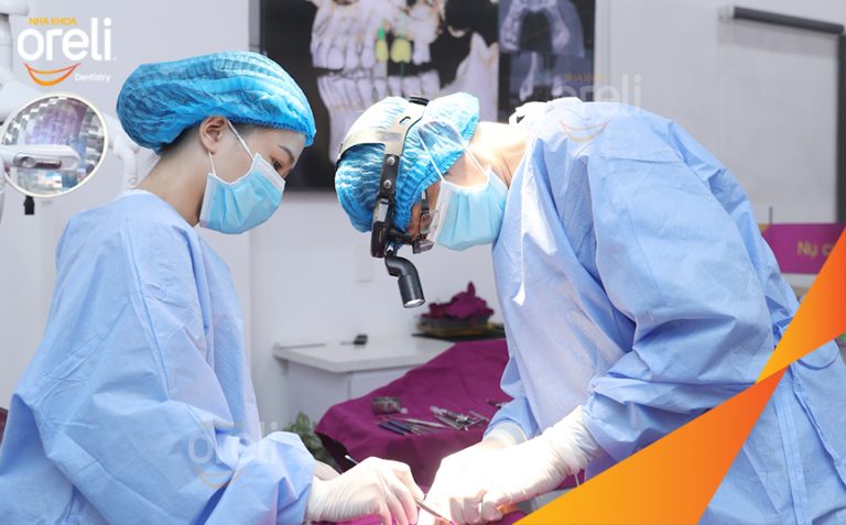 Phục Hồi Răng Mất Hàm Trên Bằng Implant Tại Nha Khoa Oreli